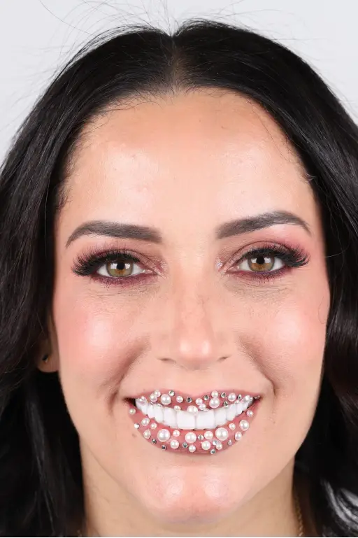 sonrisa1 (13)